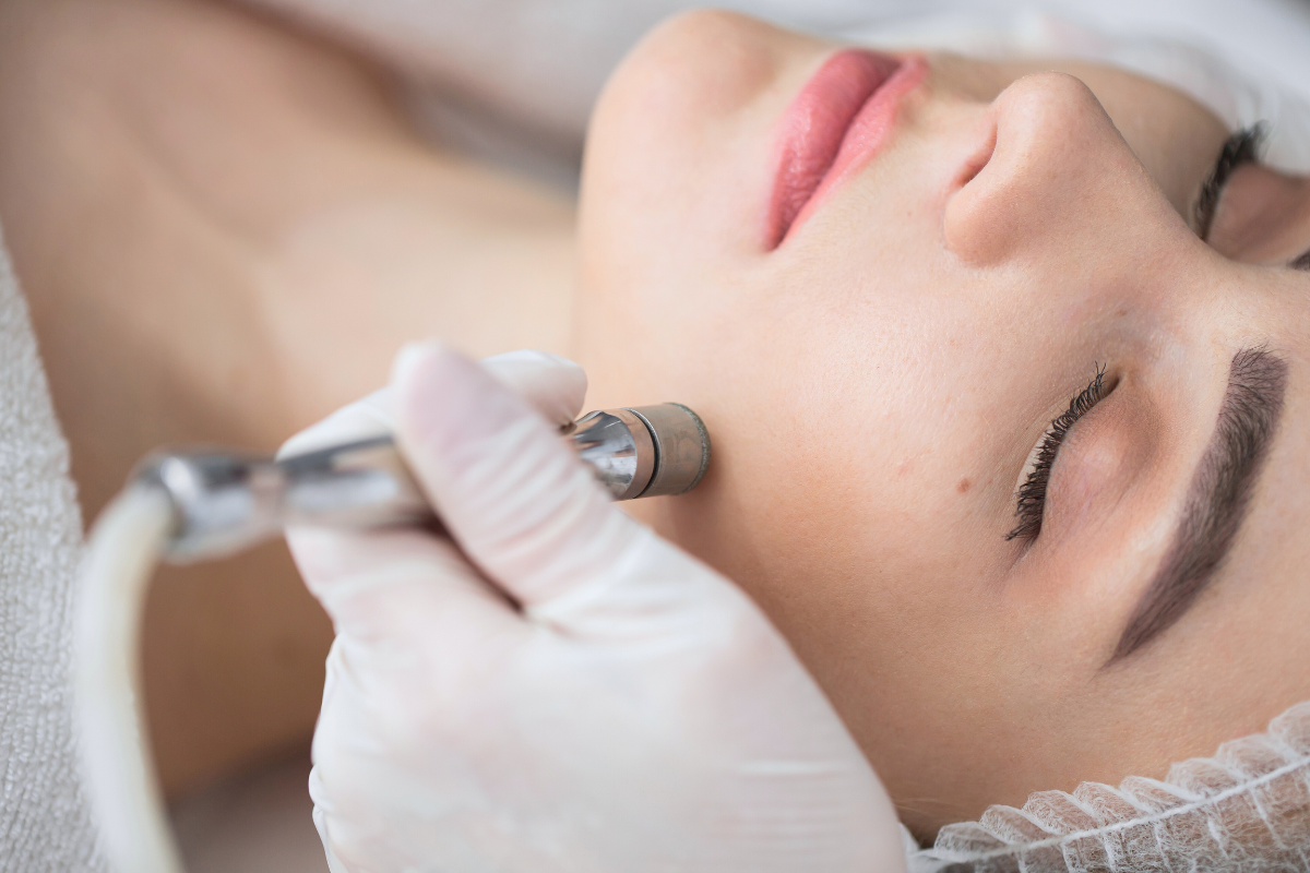 Microdermabrasion Gesichtsbehandlung bei Zauberhaft Kosmetik zur Hauterneuerung