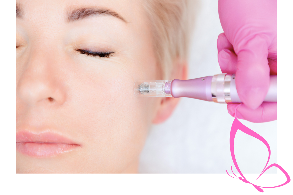 Anti-Aging Microneedling bei Zauberhaft Kosmetik mit Ferulasäure und Lifting-Effekt