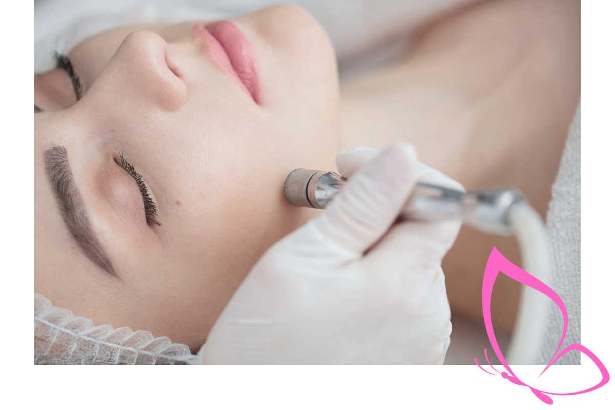 Microdermabrasion bei Zauberhaft Kosmetik für glatte, ebenmäßige Haut